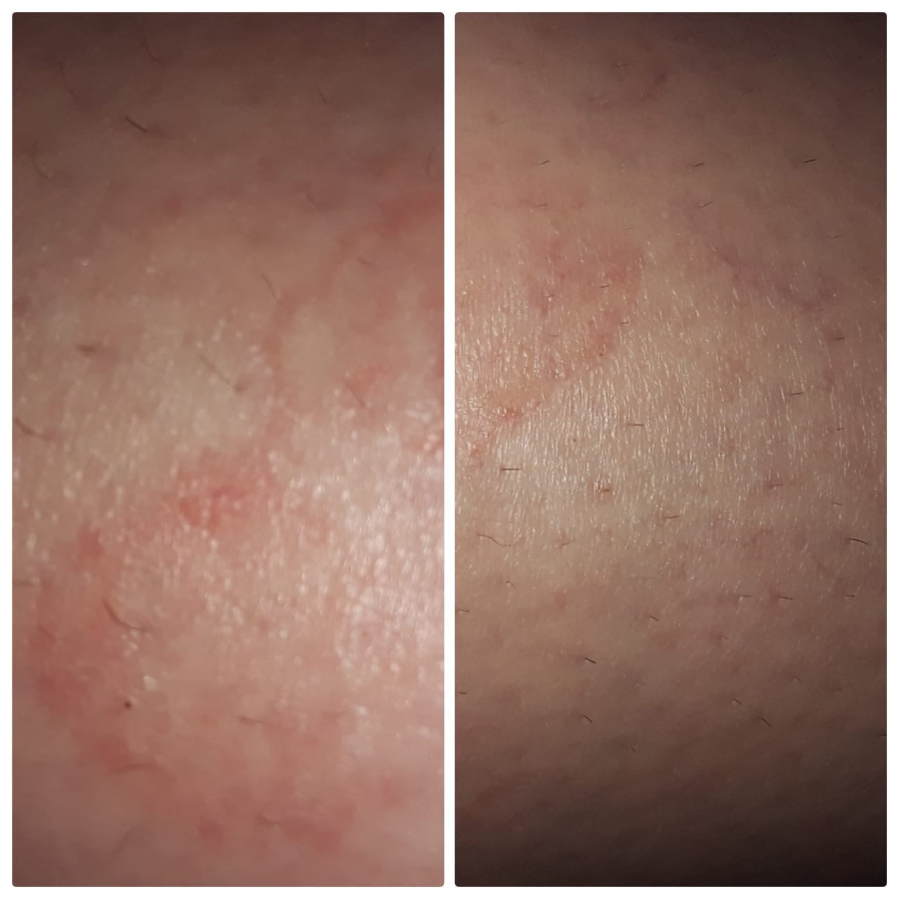 50ml Hemp and Moringa Balm